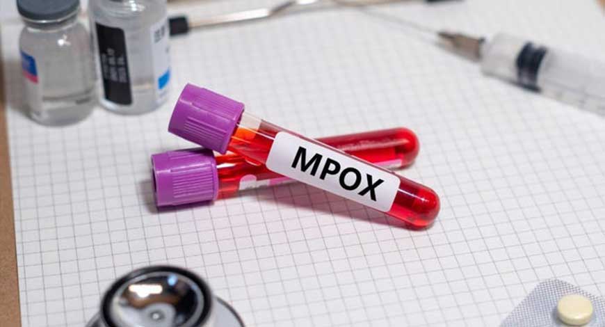 India prepares for Mpox outbreak: Health Ministry issues guidelines for airports and hospitals